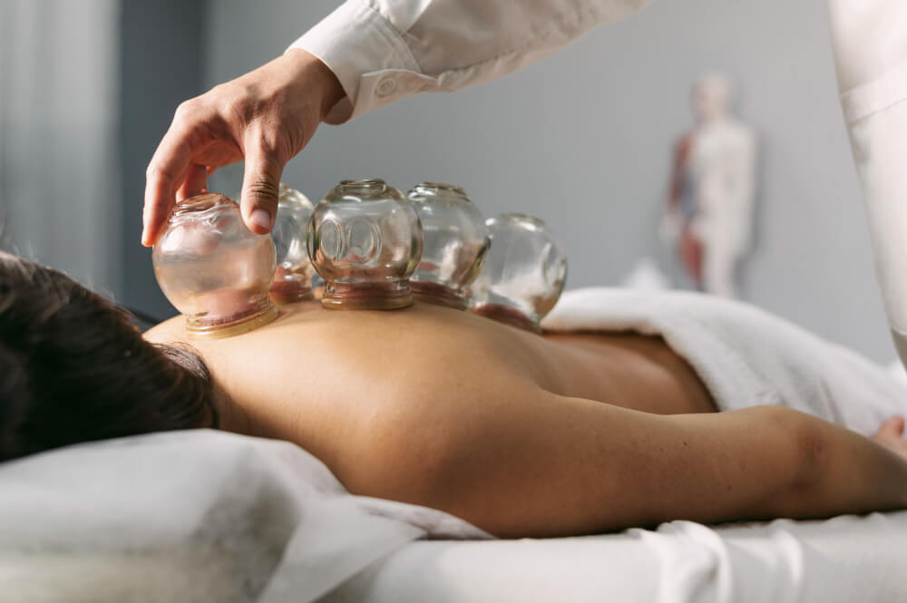 Cupping Therapy in Winter Park FL